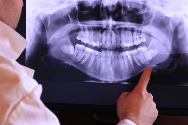 Best Emergency Treatment for Toothache in Seaside, OR
